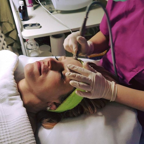 Microdermabraziune Microdermabraziune