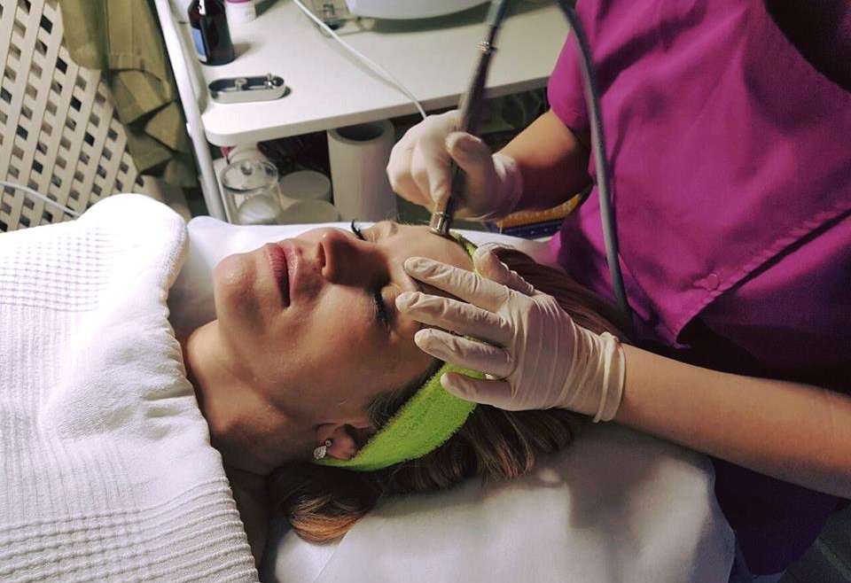 Microdermabraziune